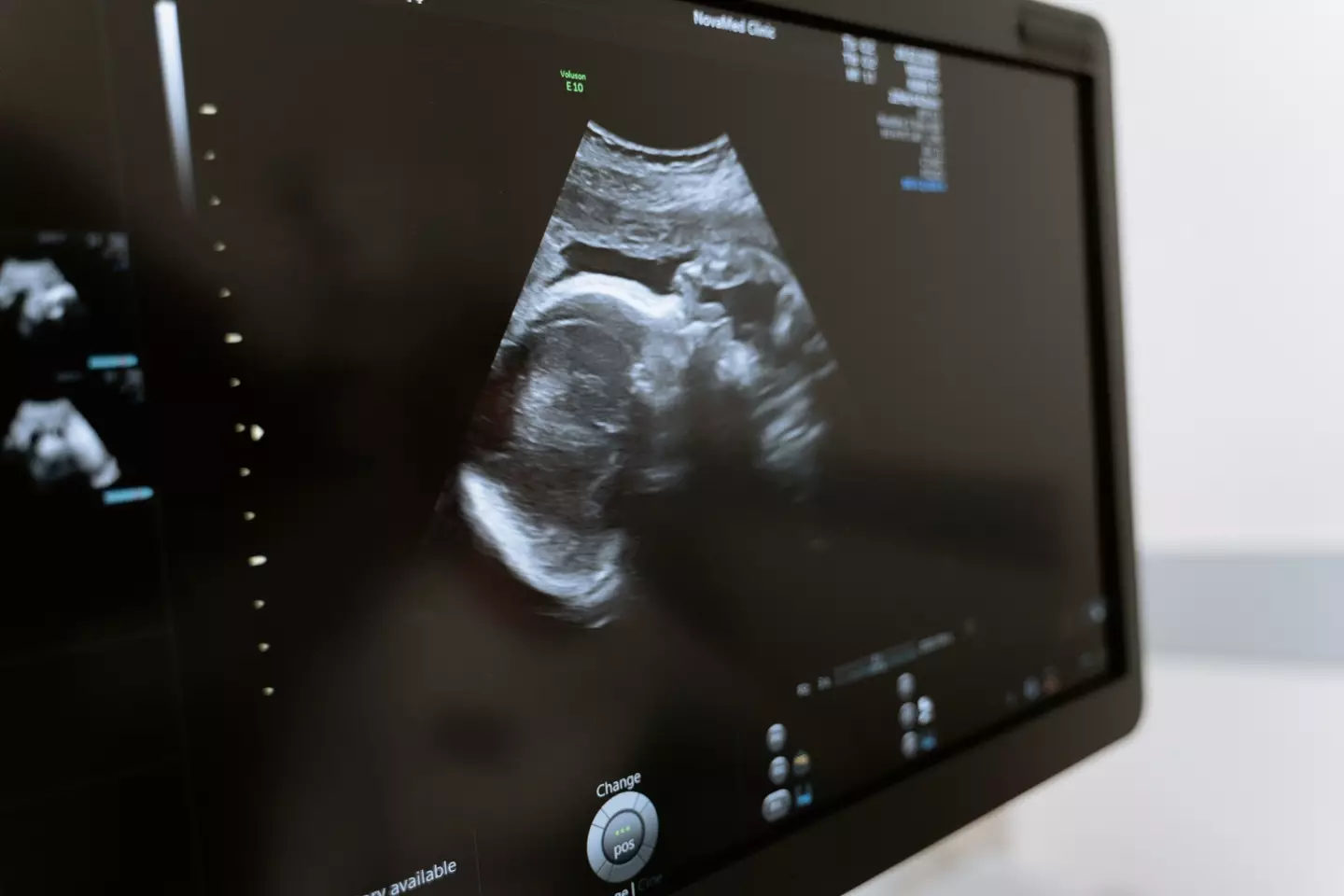 Medics used an ultrasound to guide them during the procedure.