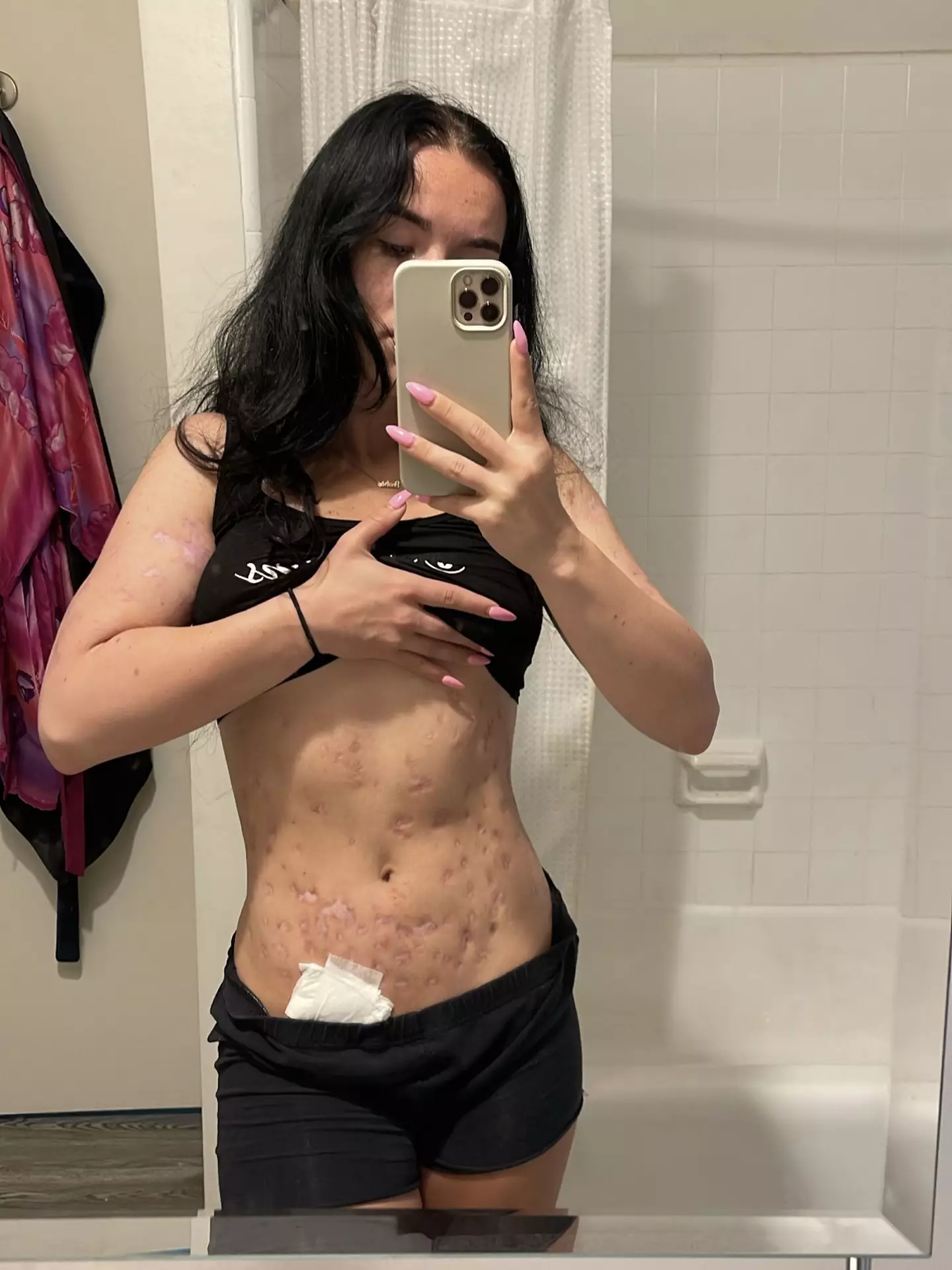 The fitness influencer feared she was going to die.