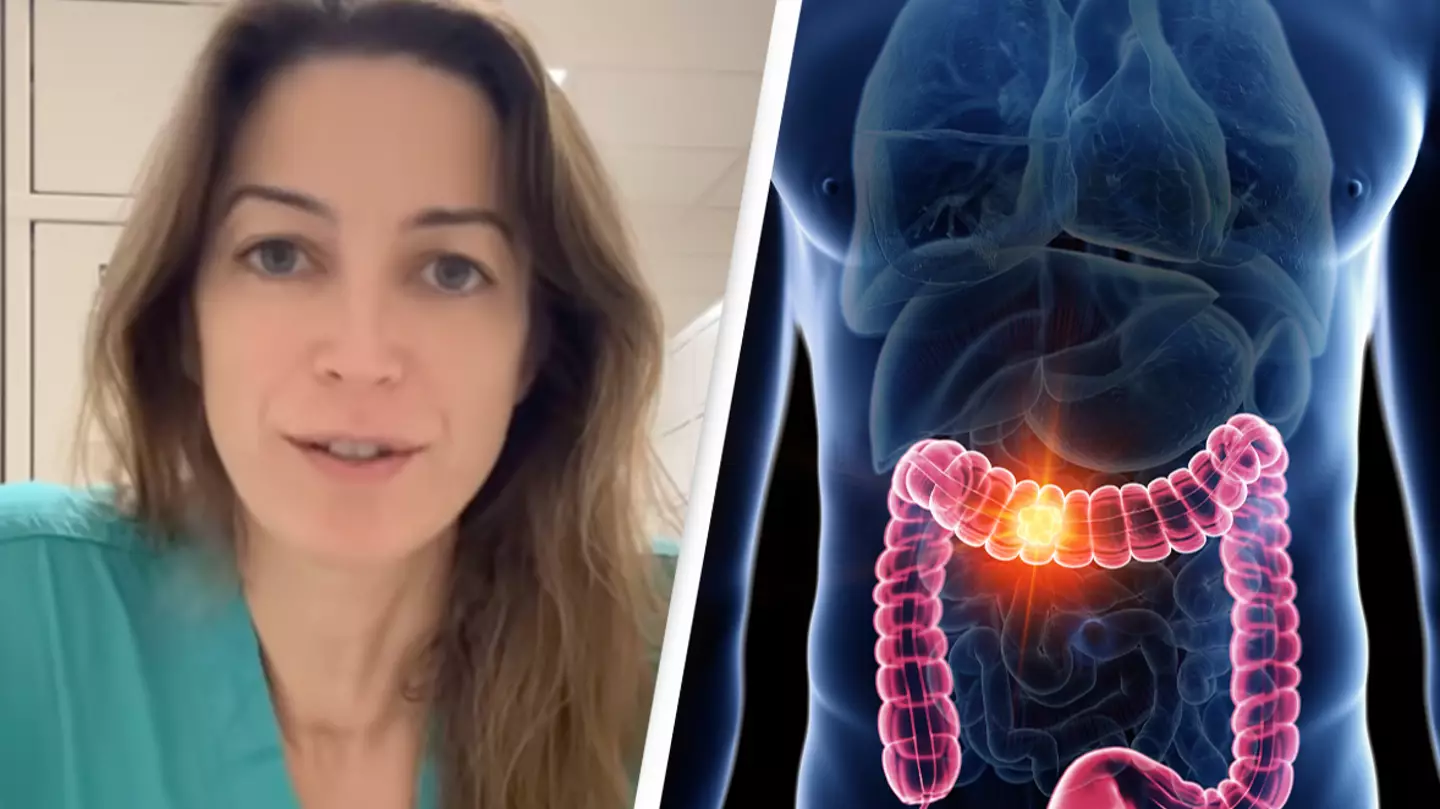 Doctor who was diagnosed with stage 4 colon cancer shares two specific symptoms to look out for