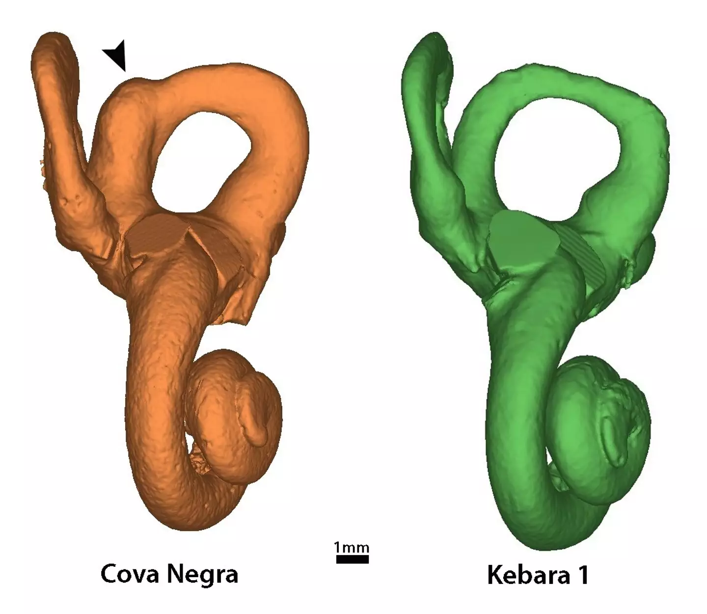 A digital scan a showed reduced volume in the cochlear. (Science Advances)