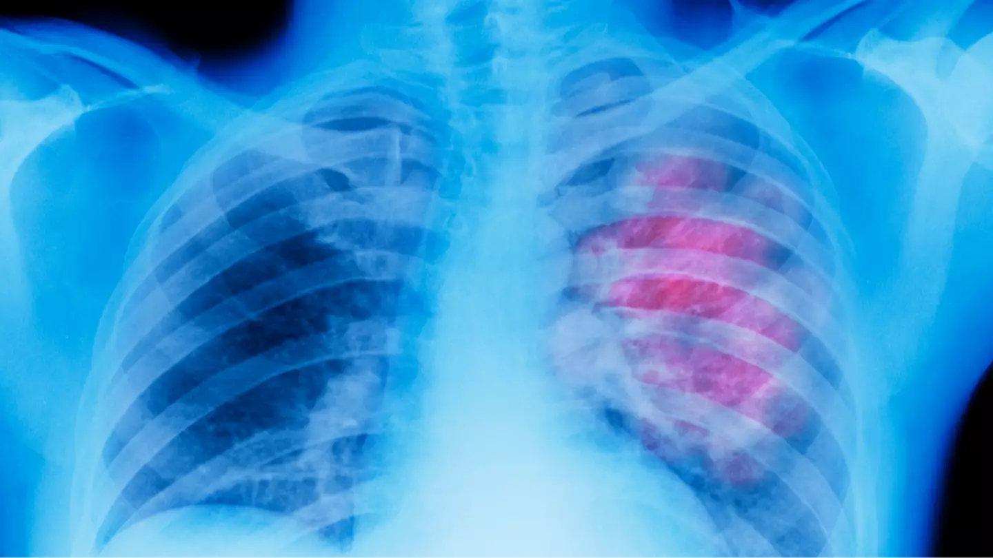 Getty Images/Peter Dazeley