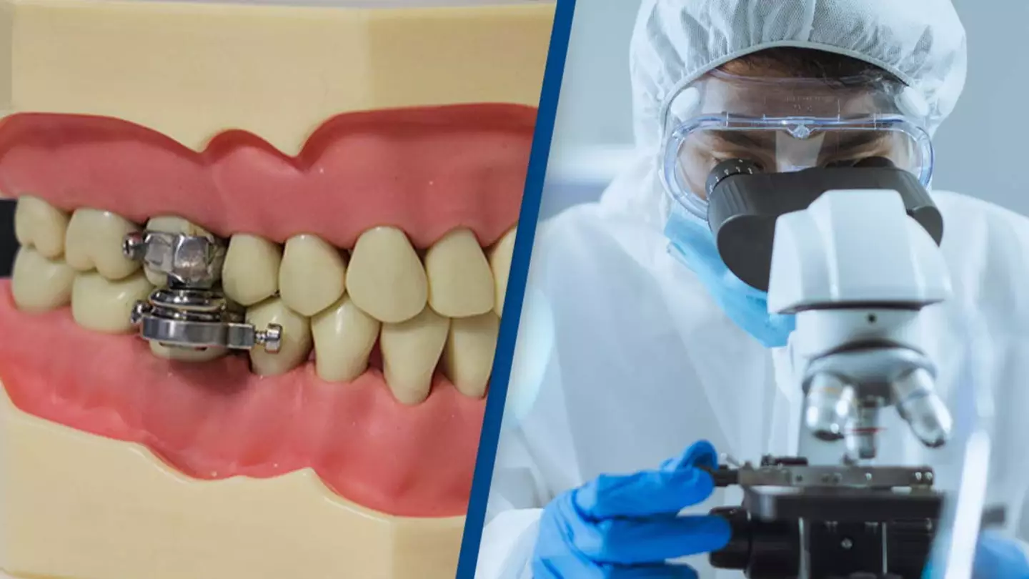 Scientists invented 'weight-loss device' that locks jaw shut and people are outraged