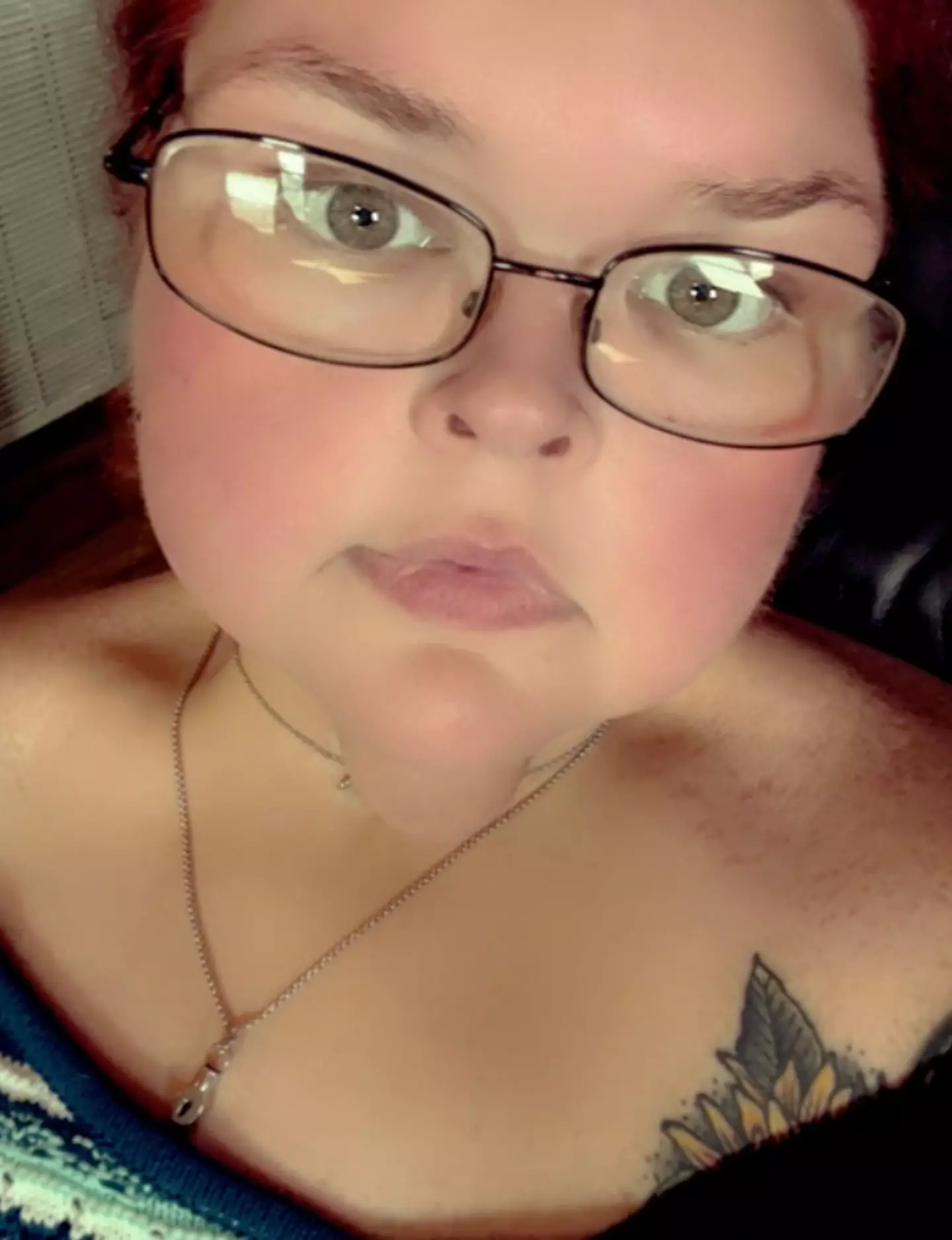 The photograph shows a significant difference in how Tammy's face now looks.