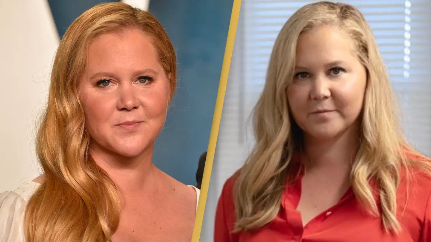 Amy Schumer reveals she has compulsive hair pulling disorder trichotillomania