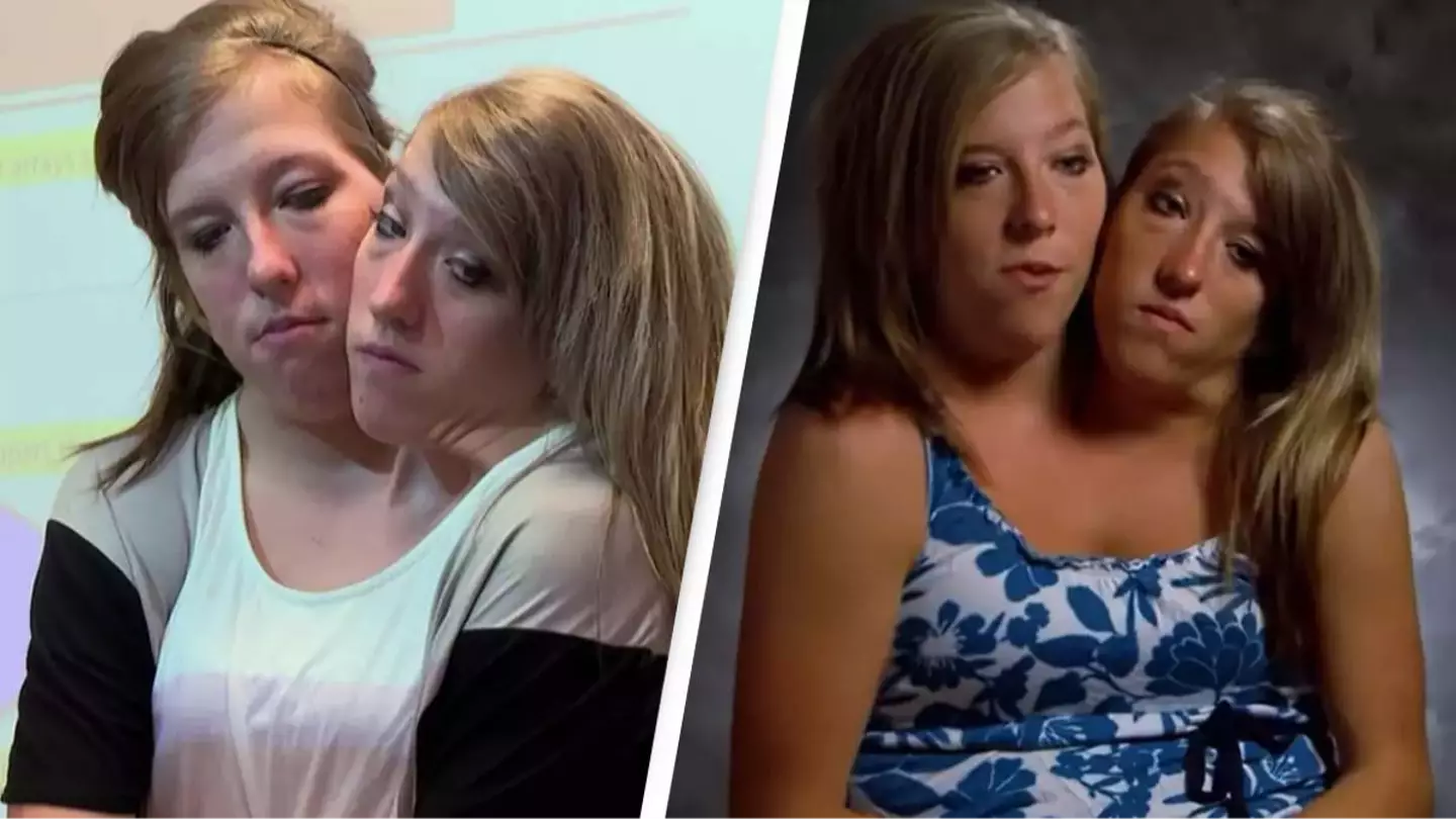 Conjoined twins opened up on what their life was like after becoming teachers