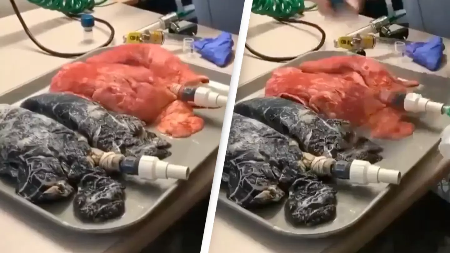 'Terrifying' footage shows breathing with a normal lung compared to a smoker's lung
