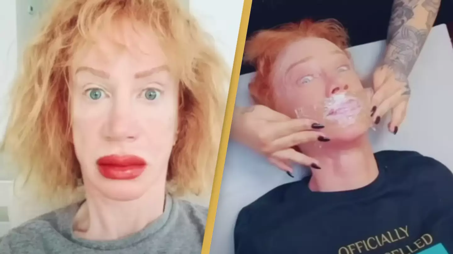 Comedian Kathy Griffin suffers swollen lips after cosmetic procedure