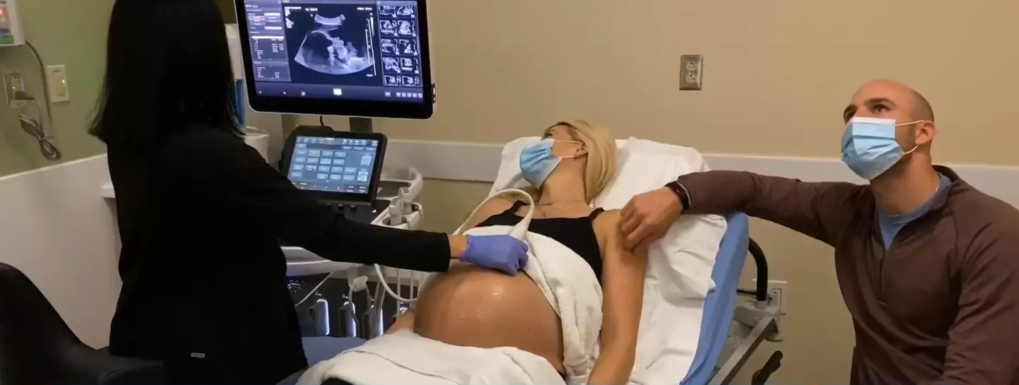 Ultrasound scan (TODAY)