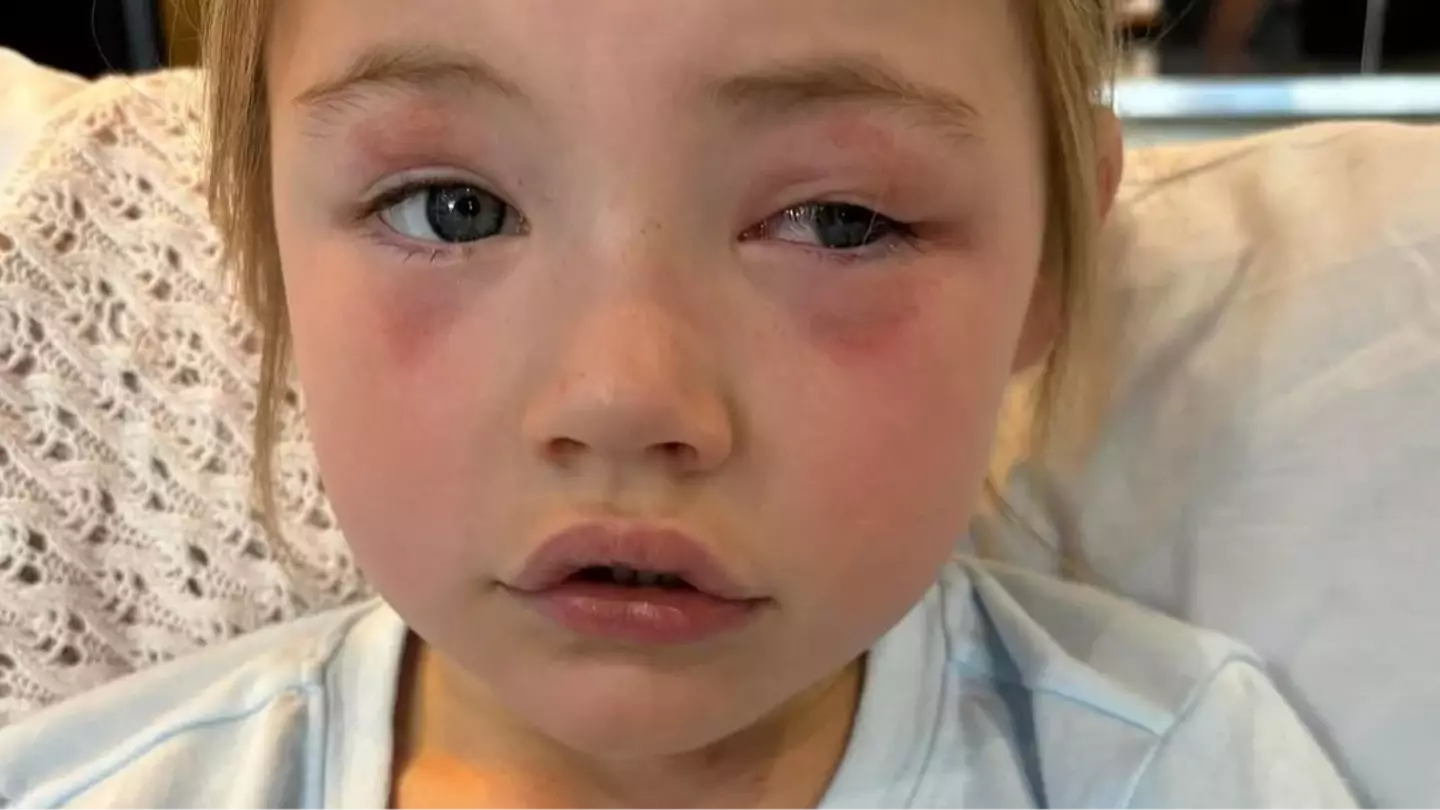4-year-old girl 'left blind in one eye' after eating common house item given by mom to hold