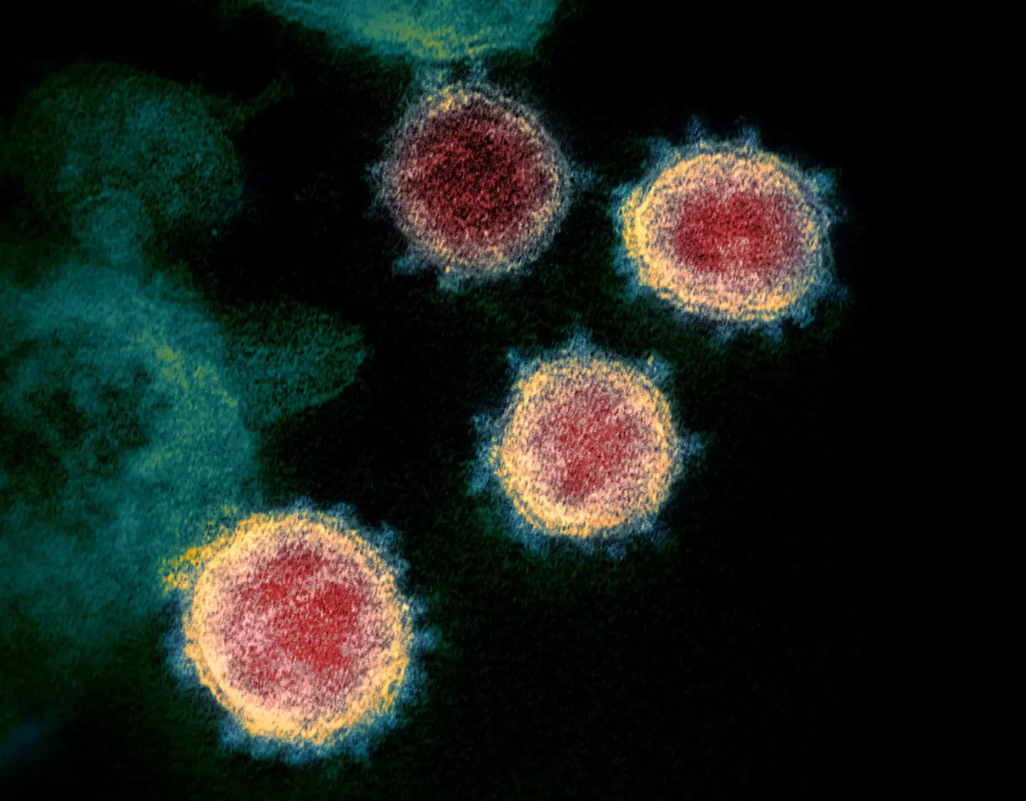 The coronavirus pandemic is not yet over (Alamy)