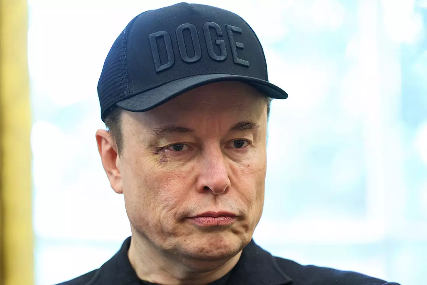 People were quick to notice Musk had a bruised eye during his farewell event at the White House (Tom Brenner For The Washington Post via Getty Images)