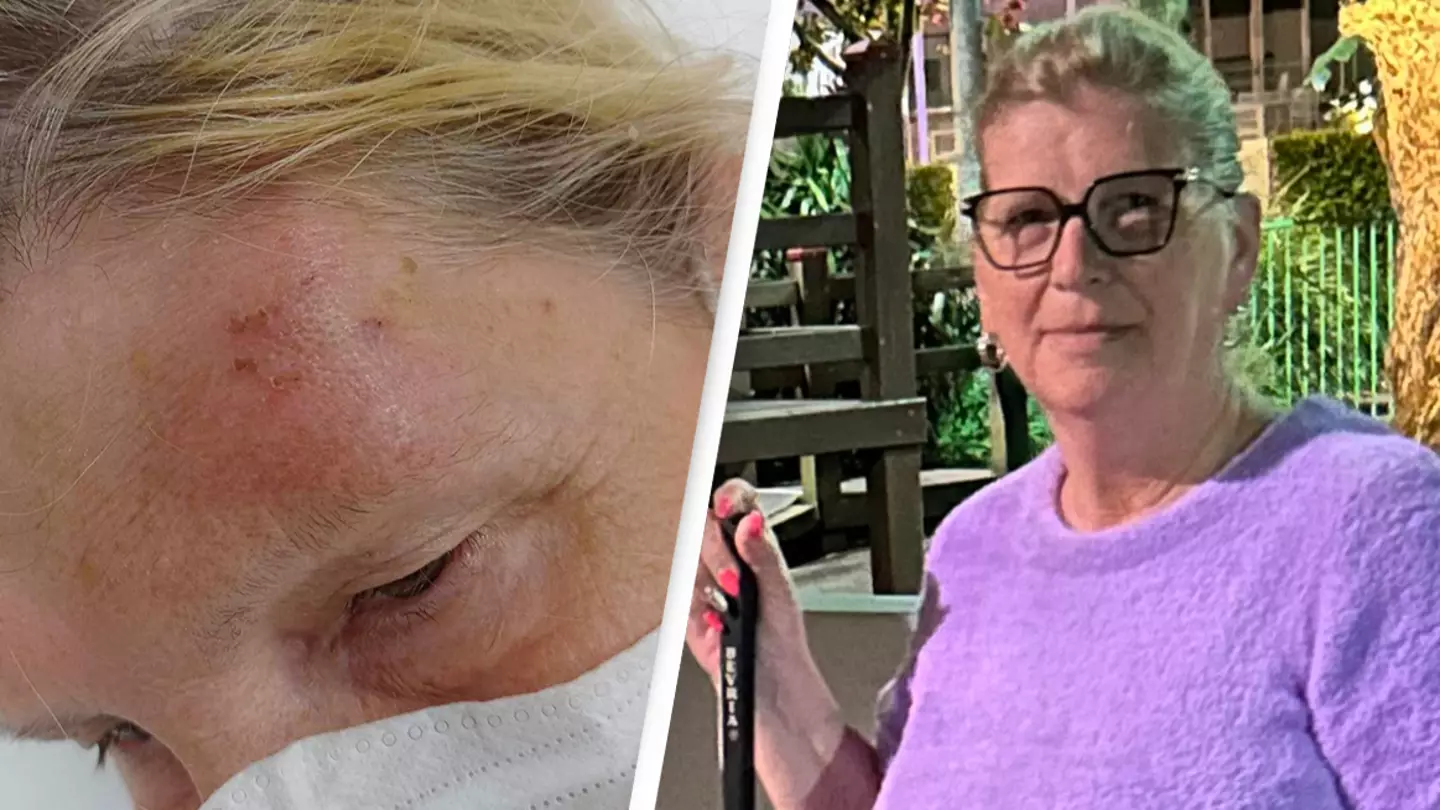 Grandmother bitten by bat fears she may have deadly virus with 100% mortality rate