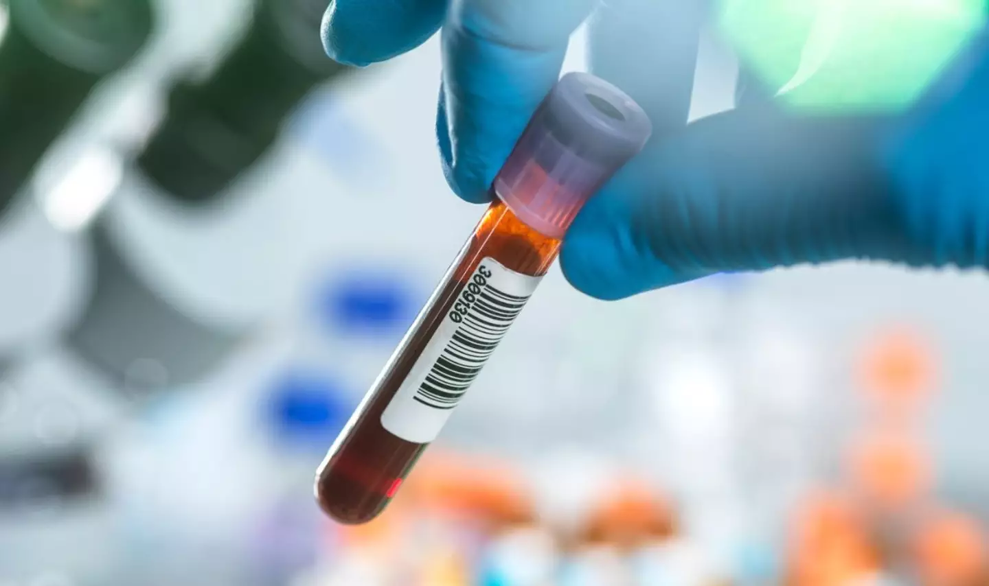 A so-called 'humanzee' was reportedly created in a lab (Getty stock image)