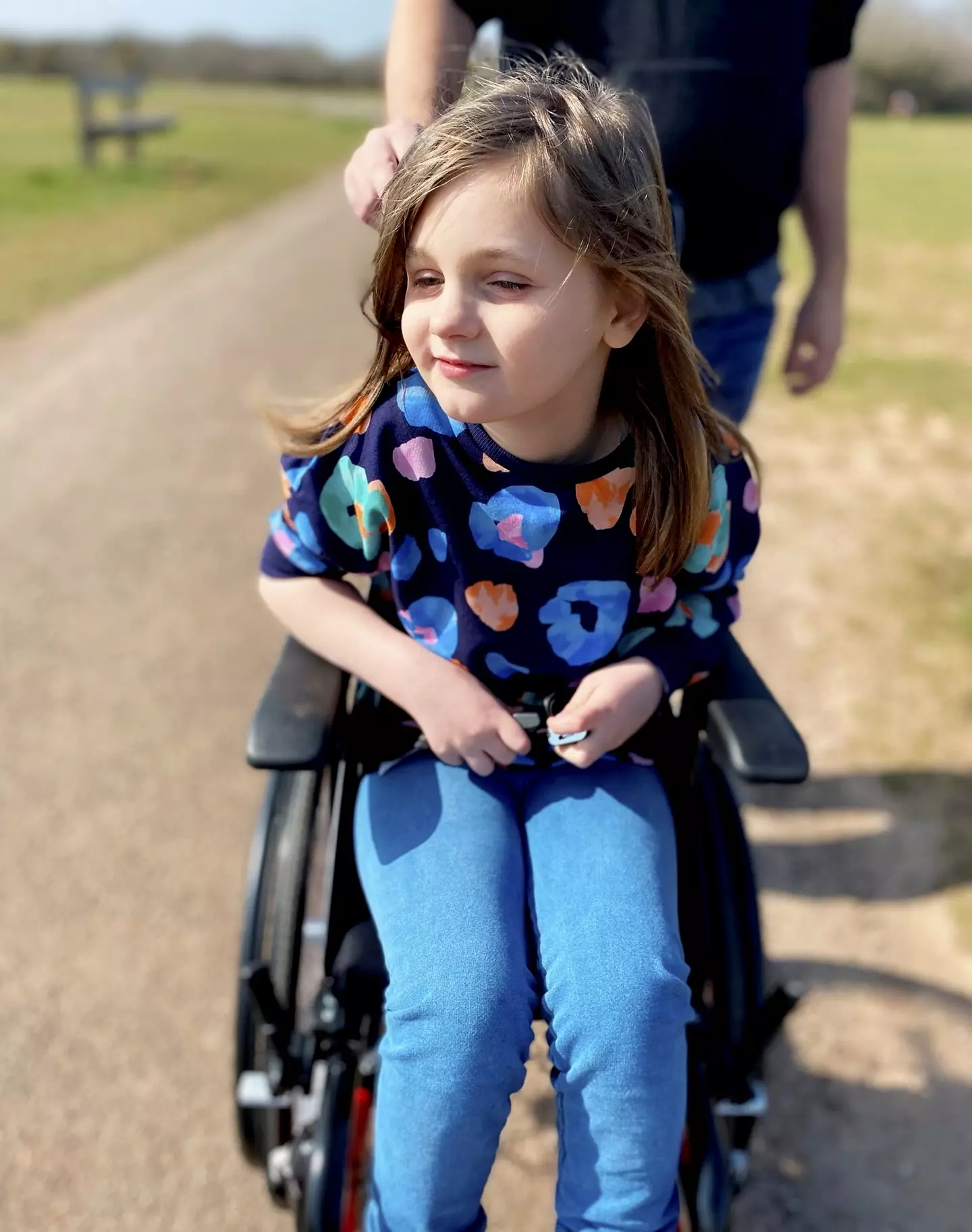 Matilda needs to use a wheelchair as it is painful to walk (SWNS)