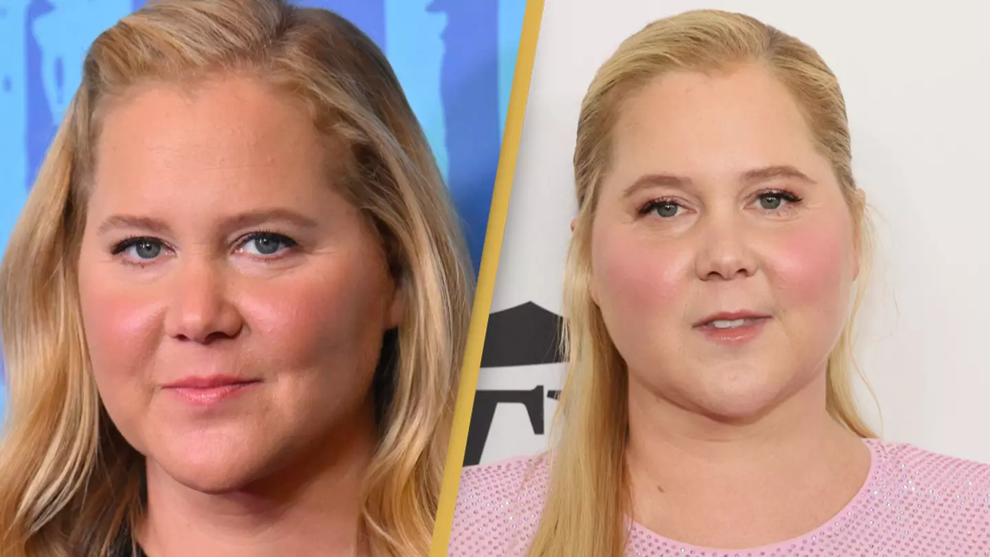 Amy Schumer says internet 'coming for her' over 'moon face' led to shock diagnosis
