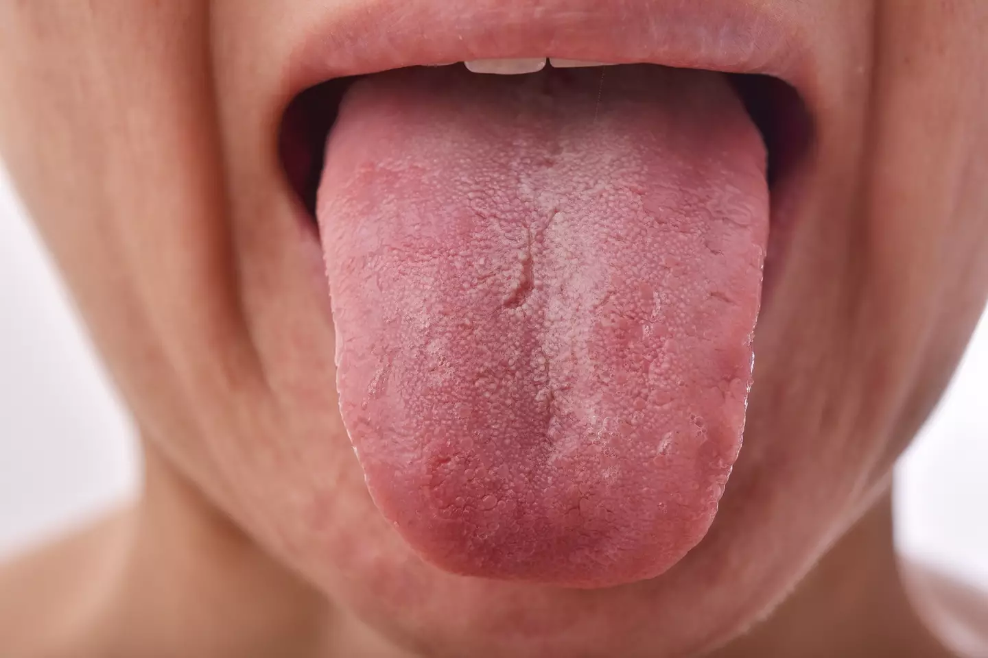 Some claim they've suffered a burning sensation in their tongue (Getty Stock Image)