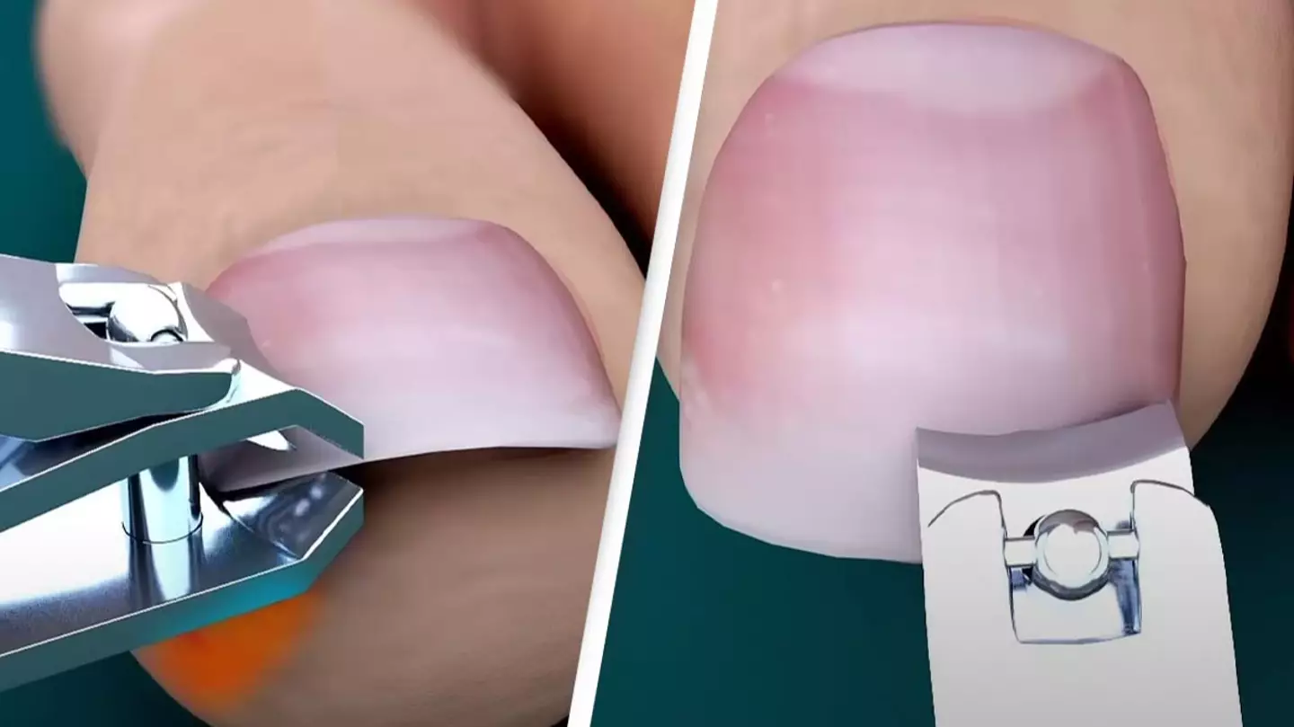 People are just realizing they've been cutting toe nails wrong after seeing bizarre simulation