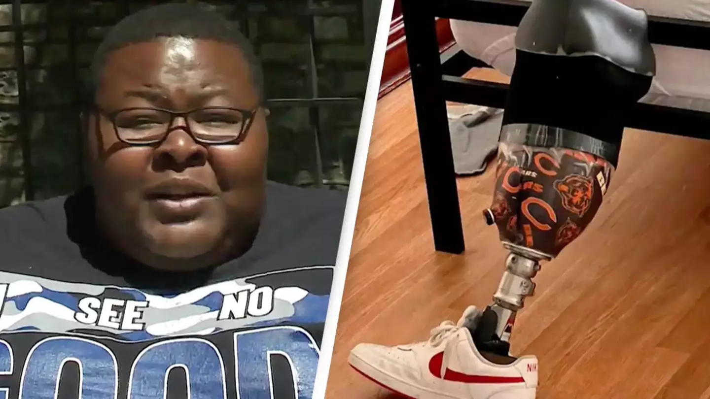 Man says American Airlines lost his prosthetic leg worth $26,000 and won’t reimburse him