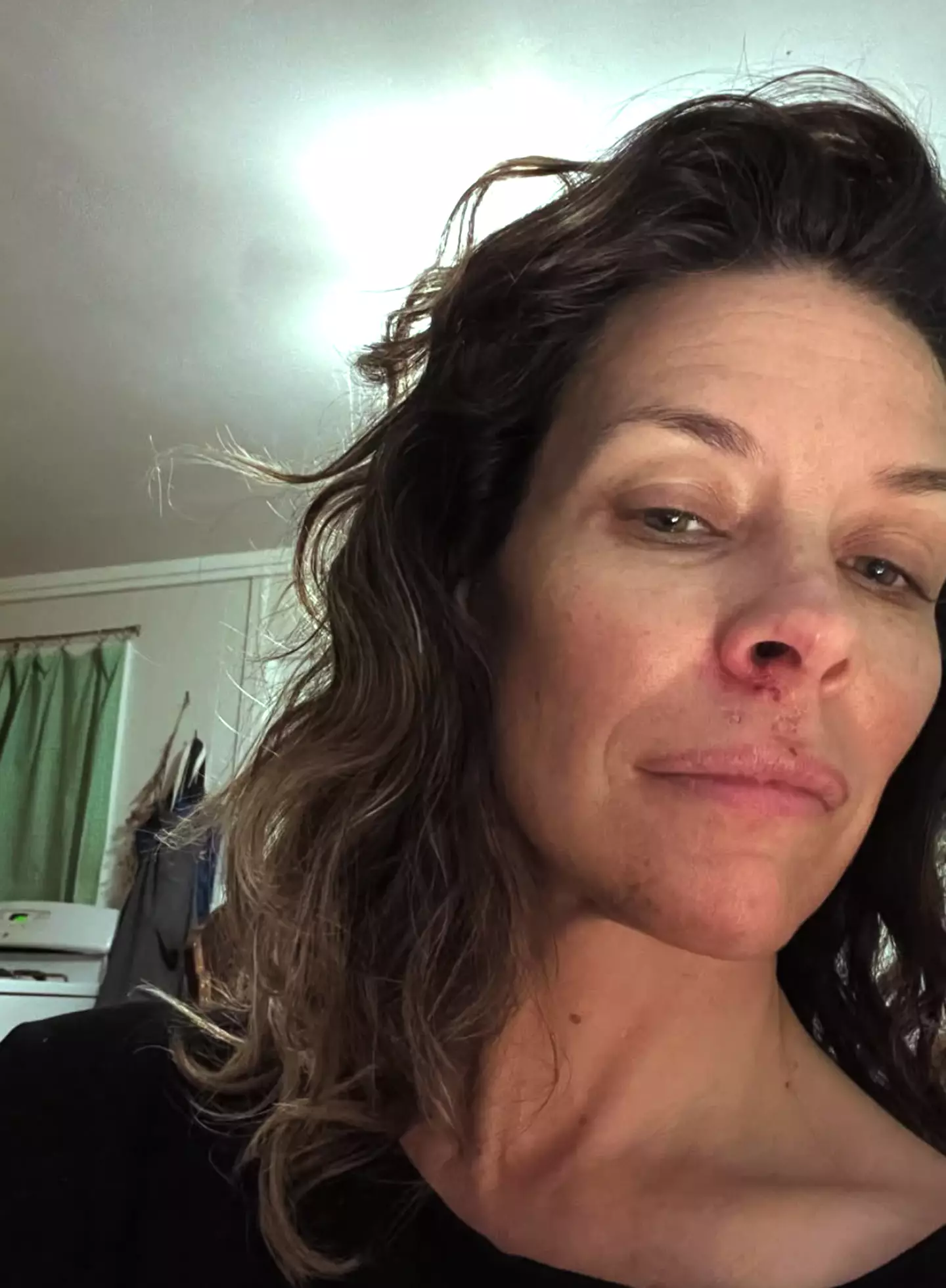 Evangeline Lilly suffered the injury after blacking out at the beach in May 2025 (evangelinelillyofficial/instagram)