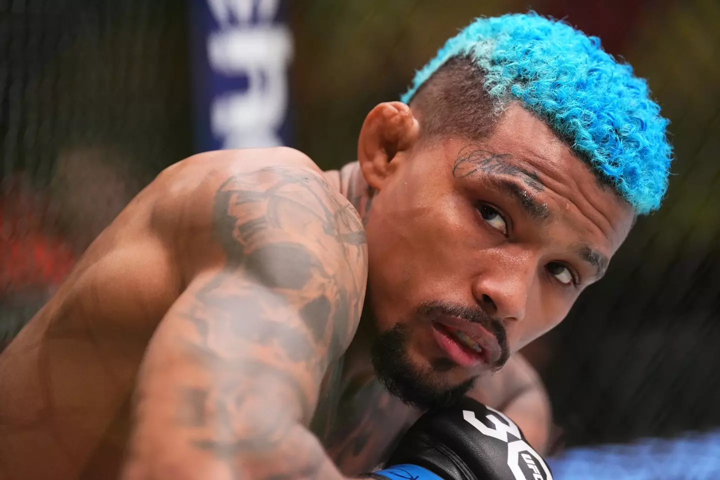 The former UFC star sustained a fractured penis (Chris Unger/Zuffa LLC via Getty Images)