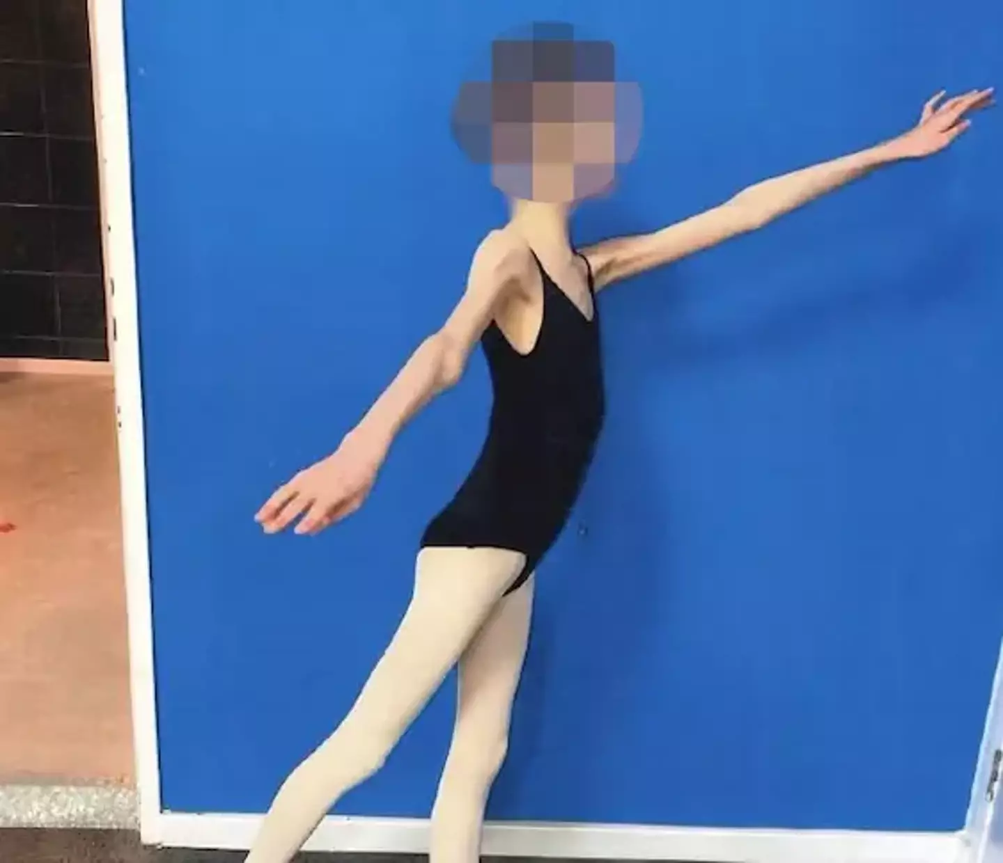 The teen only socialized with other children during ballet classes (District Court of Western Australia)