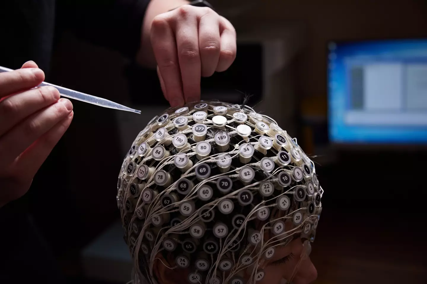 Doctors used an EEG to monitor the man's brain.