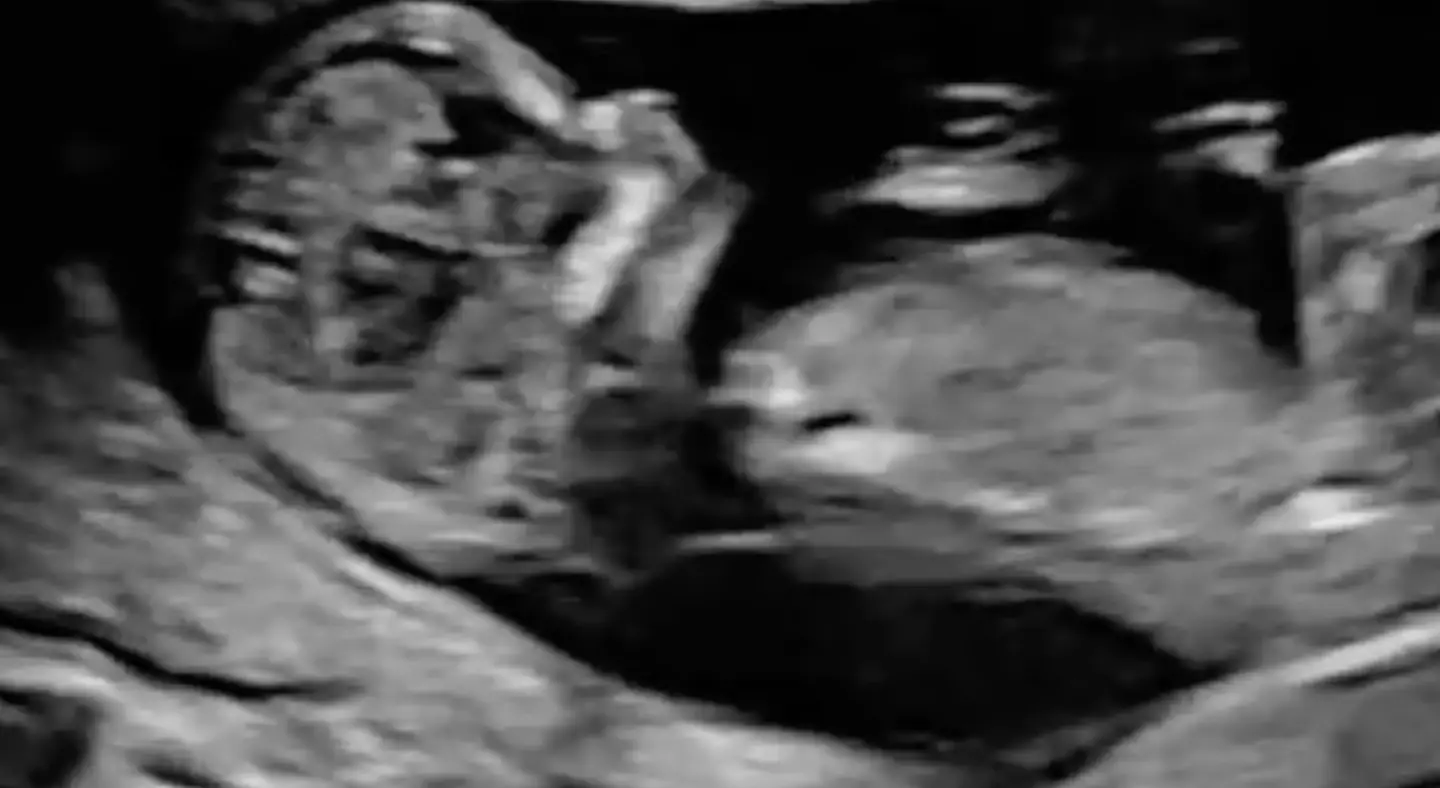 PewDiePie showed scans of the baby in the announcement video.