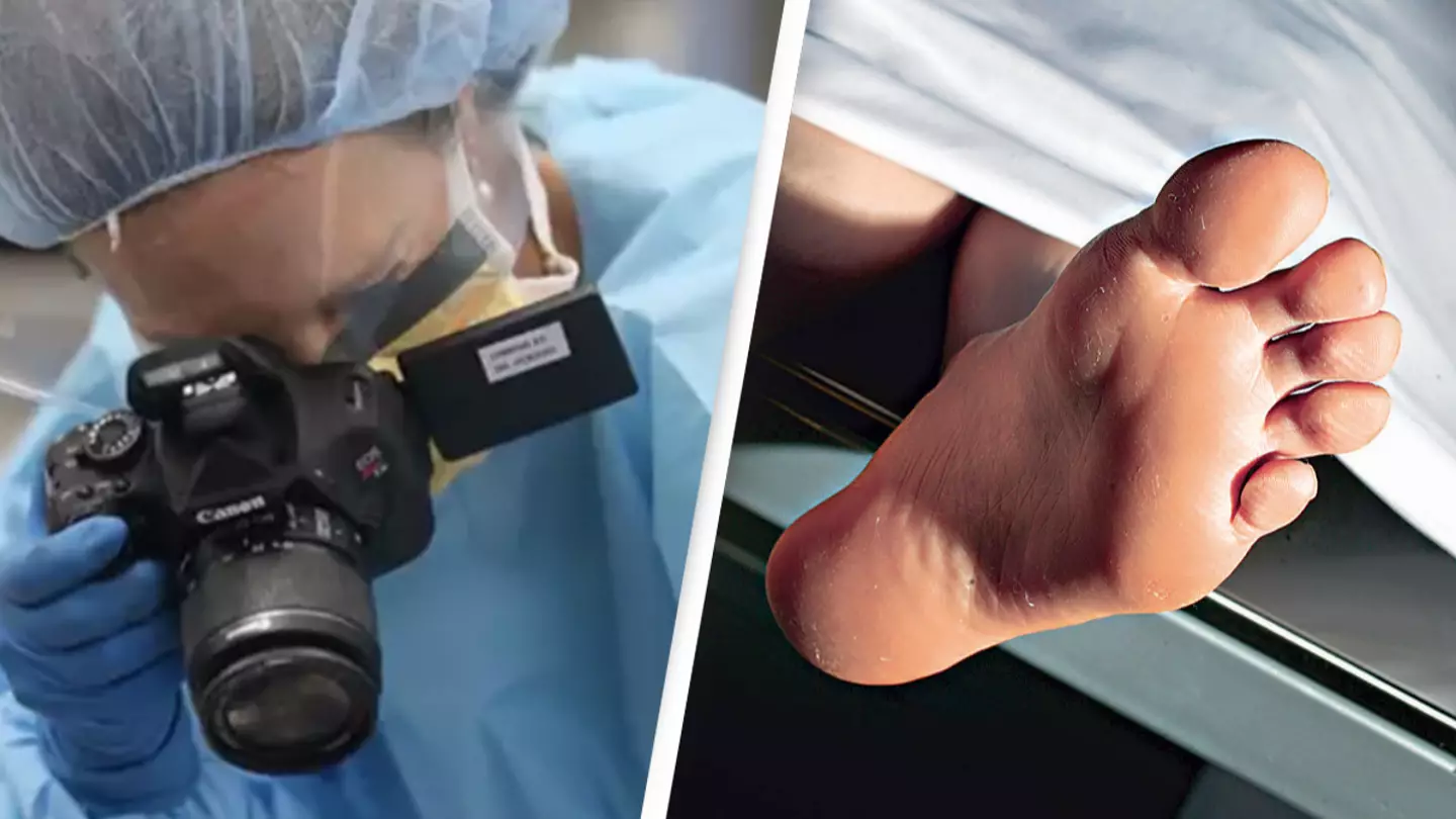 Medical examiner says worst death seen was man who was thrown down a manhole into boiling water