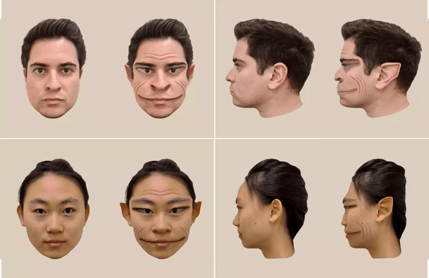The condition makes other people's faces appear distorted. (Antônio Mello/Dartmouth College)