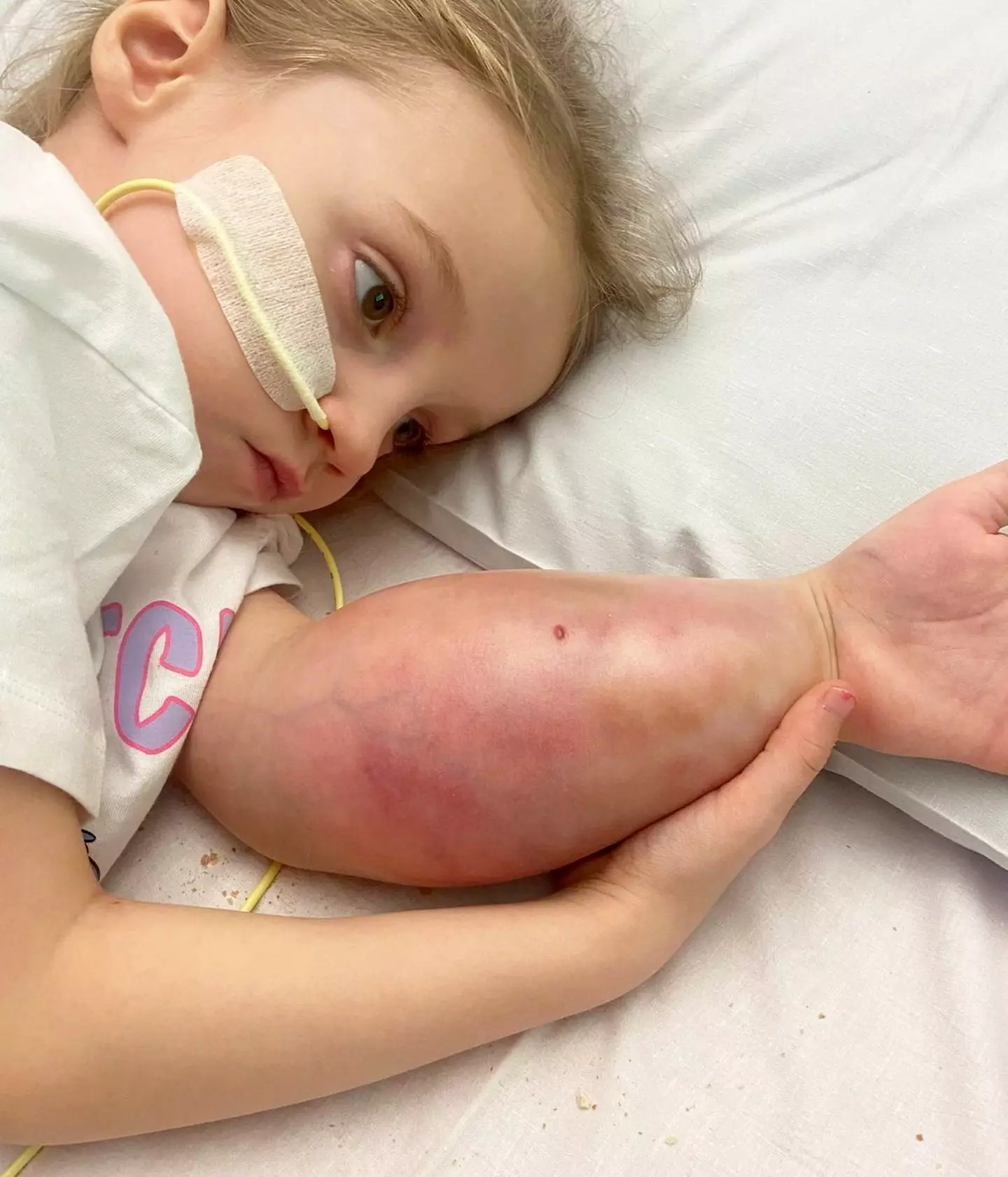 Her tumor was thought to be a sprain (SWNS)
