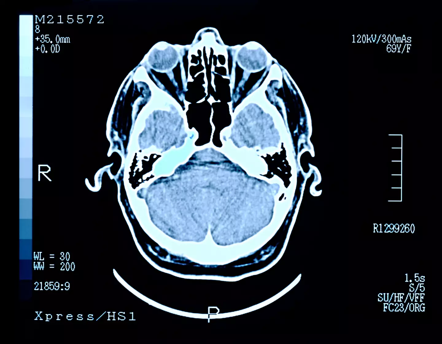 Our brains seem to give us a shot of memories when dying. (Getty Stock Photo)
