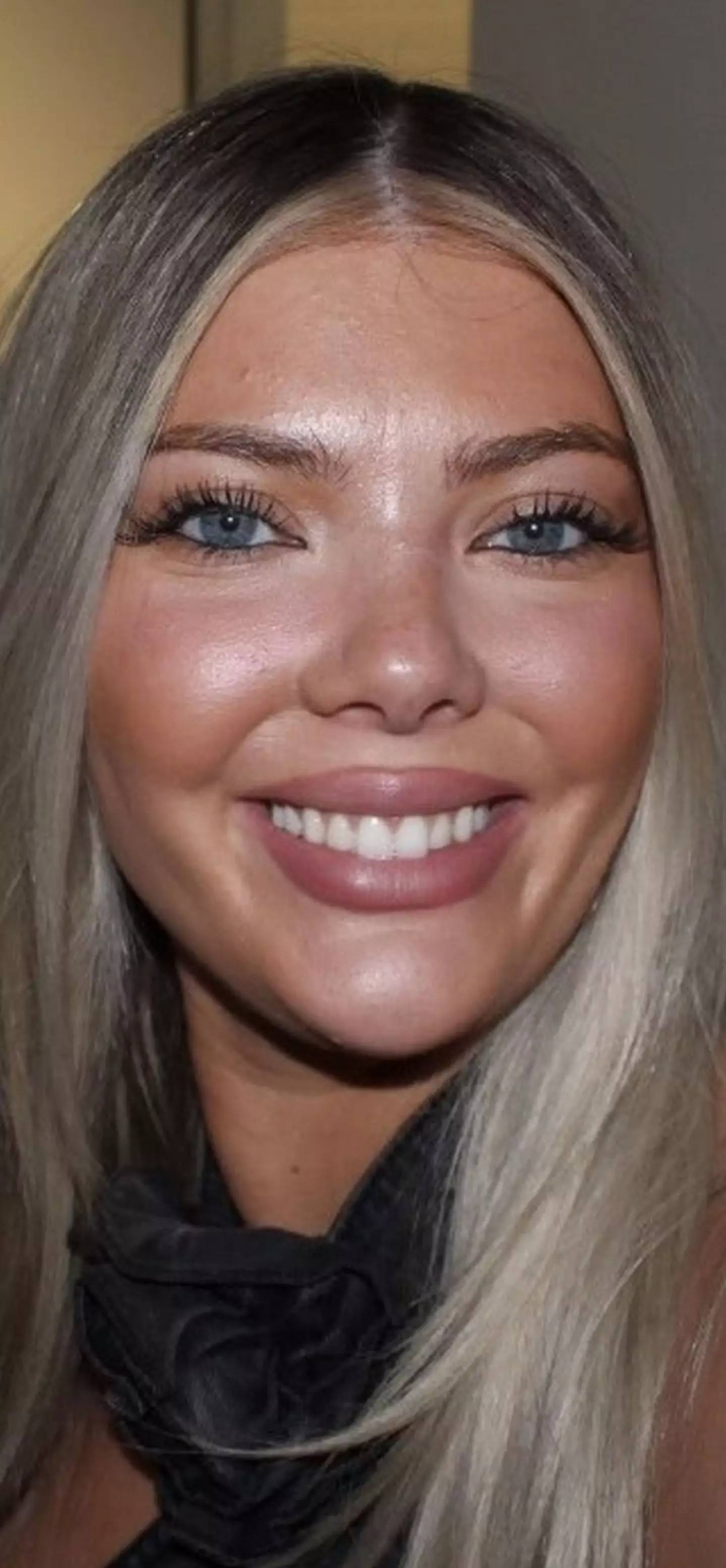 Brooklyn McCasland thought it was probably just a grain of sand caught in her eye (Kennedy News and Media)