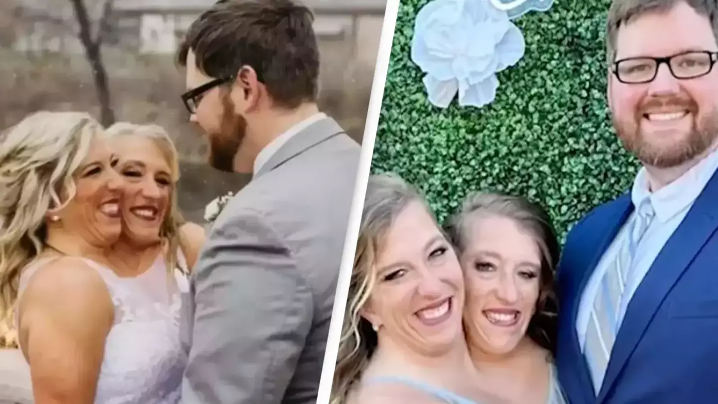 People are asking the same thing after finding out conjoined twin Abby Hensel is married
