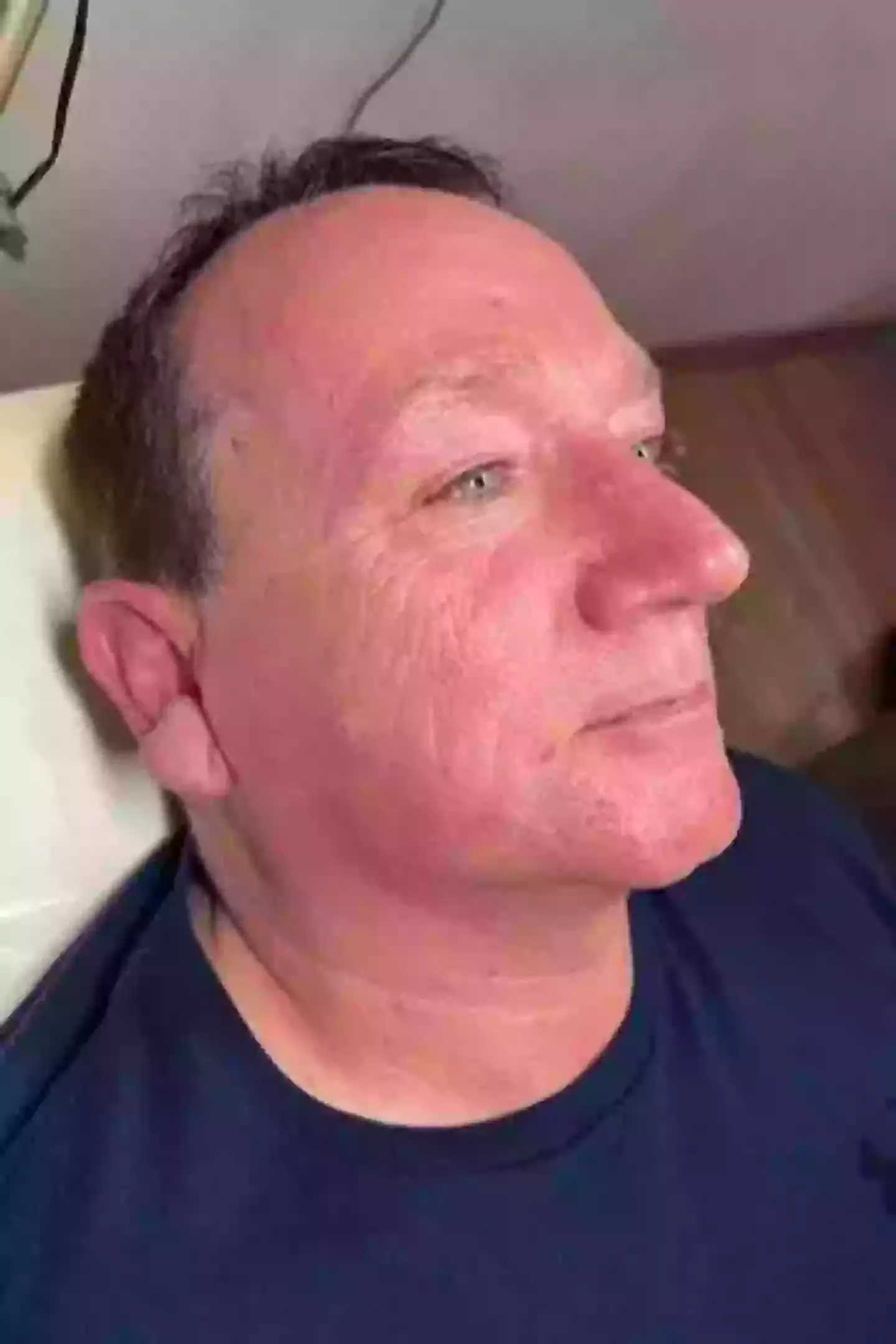 Sun had hit the right side of his face for 30 years (Positive Communications)