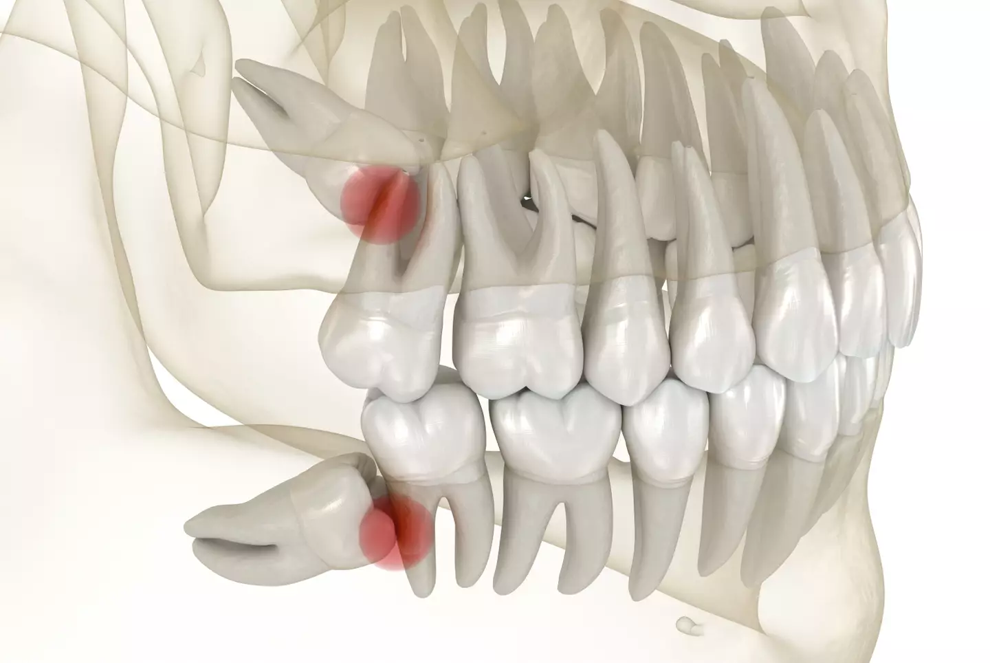 Wisdom teeth are now more of a hinderance than a help. (alex-mit/Getty Stock)