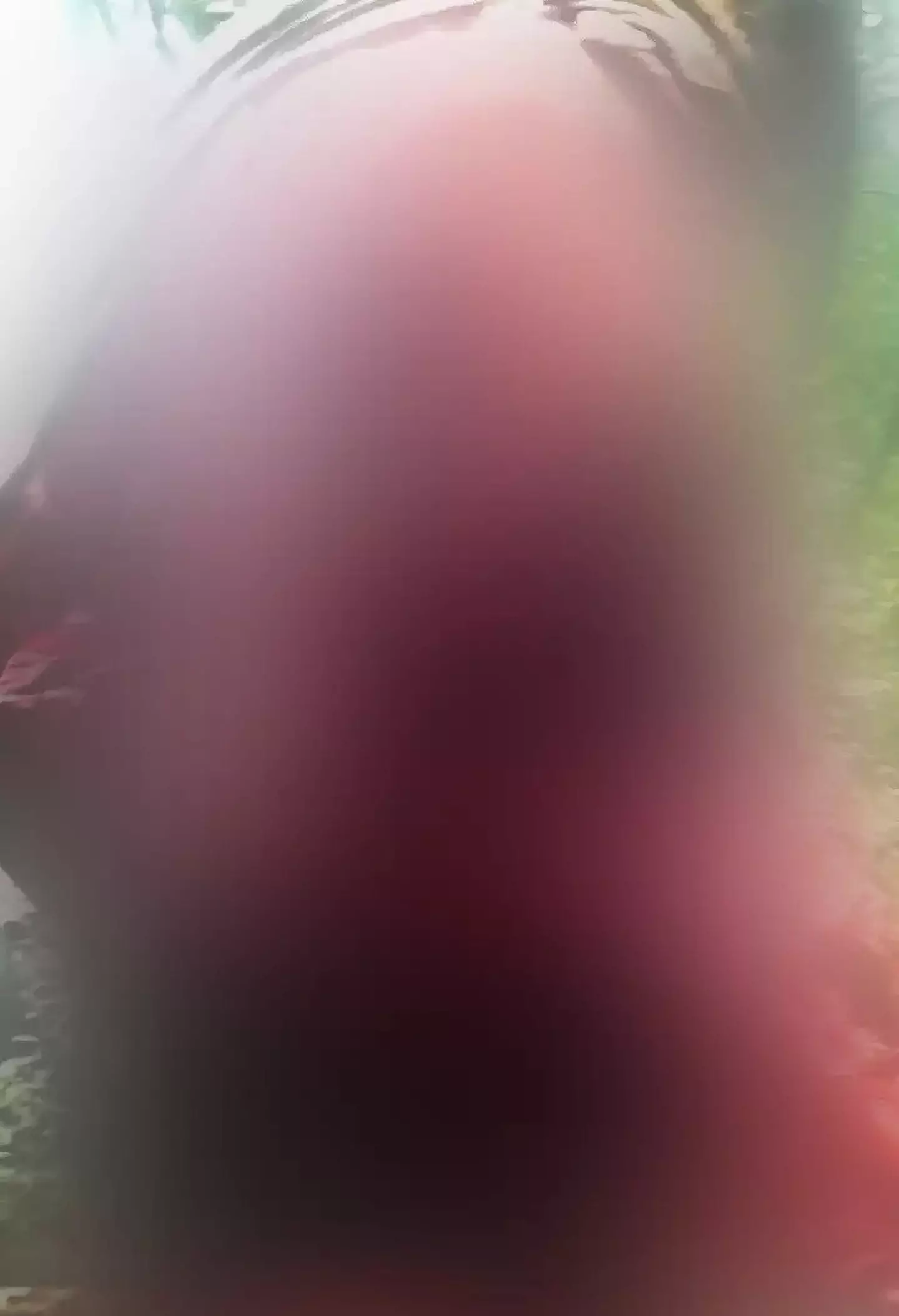 Jeremy's face was entirely ripped away by the bear.