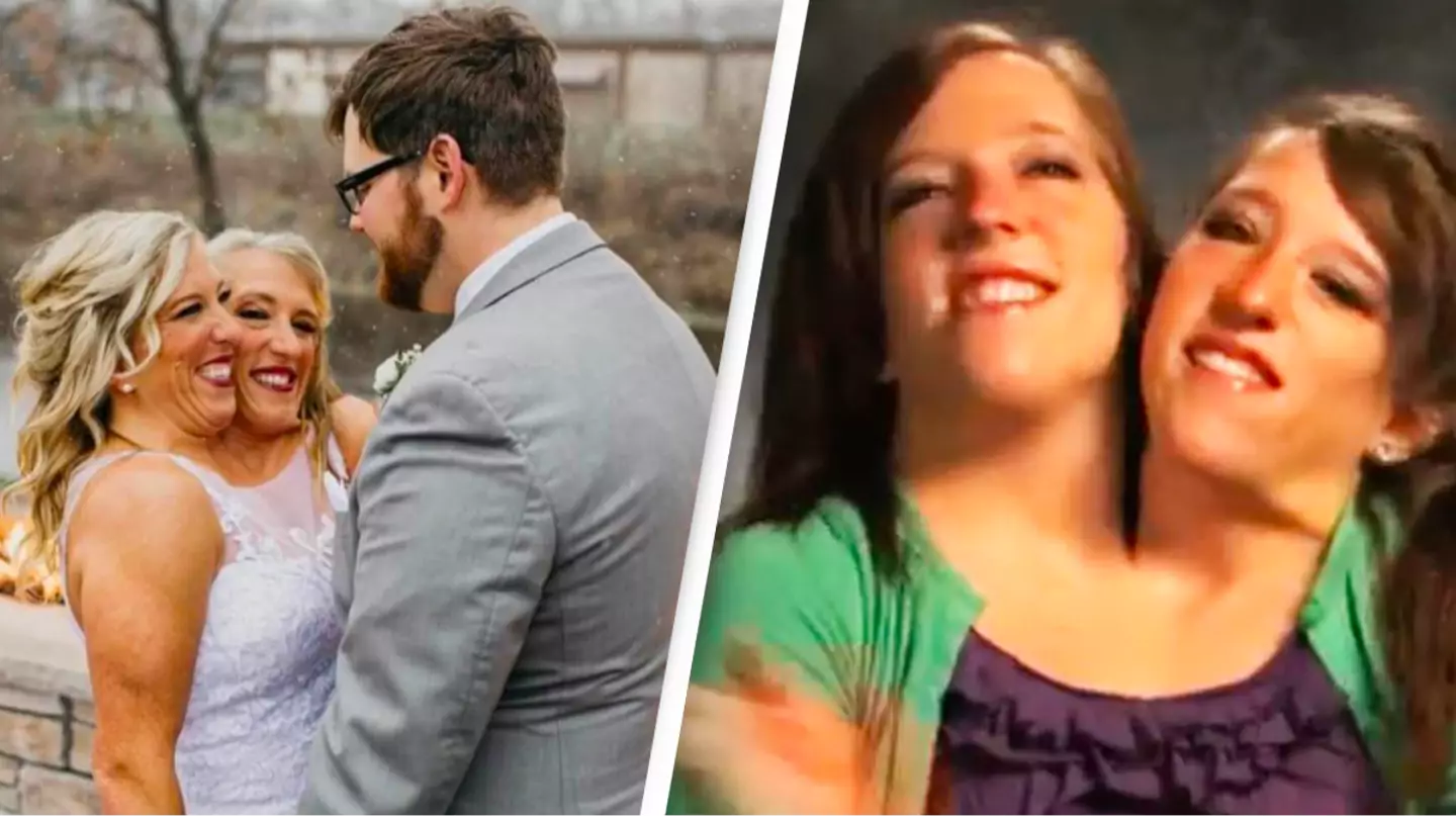 Conjoined twin Abby Hensel is now married