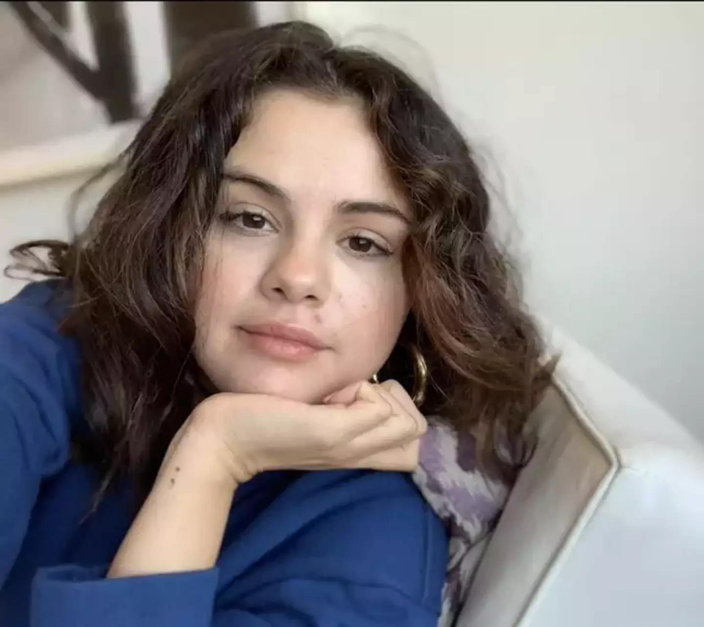 Selena underwent an urgent kidney transplant back in 2017.