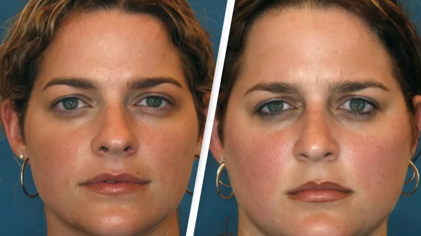 Identical twins reveal major difference to their bodies with just one of them sunbathing and smoking