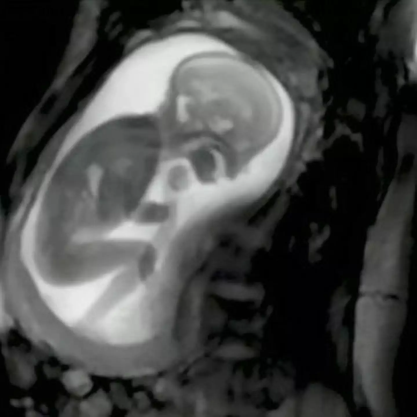 Amazingly clear MRI footage shows a baby casually ‘kicking the sh*t’ out of their mum's organs.