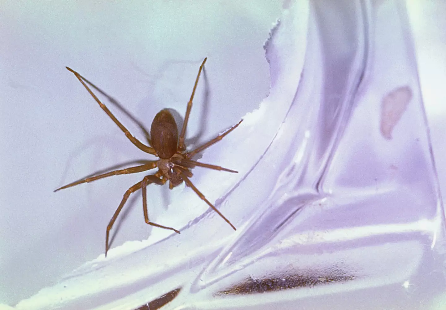 Doctors initially thought Zachary had been bitten by a brown recluse spider. (Smith Collection/Gado/Getty Images)