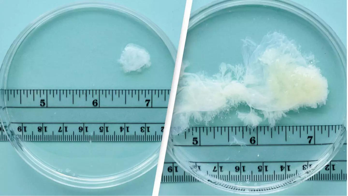 Photos showing what early abortions actually look like go viral
