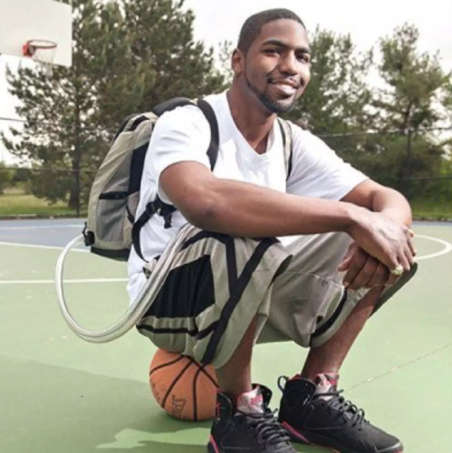 Stan Larkin lived 555 days without a heart. (CNN)