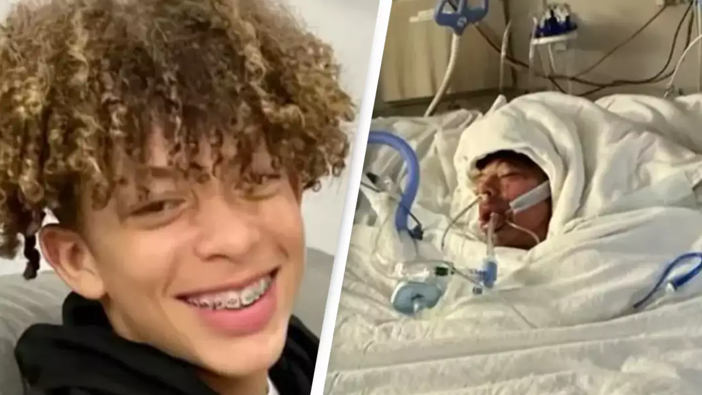 Teenager ‘unrecognizable’ after TikTok challenge left him with burns on 75% of his body