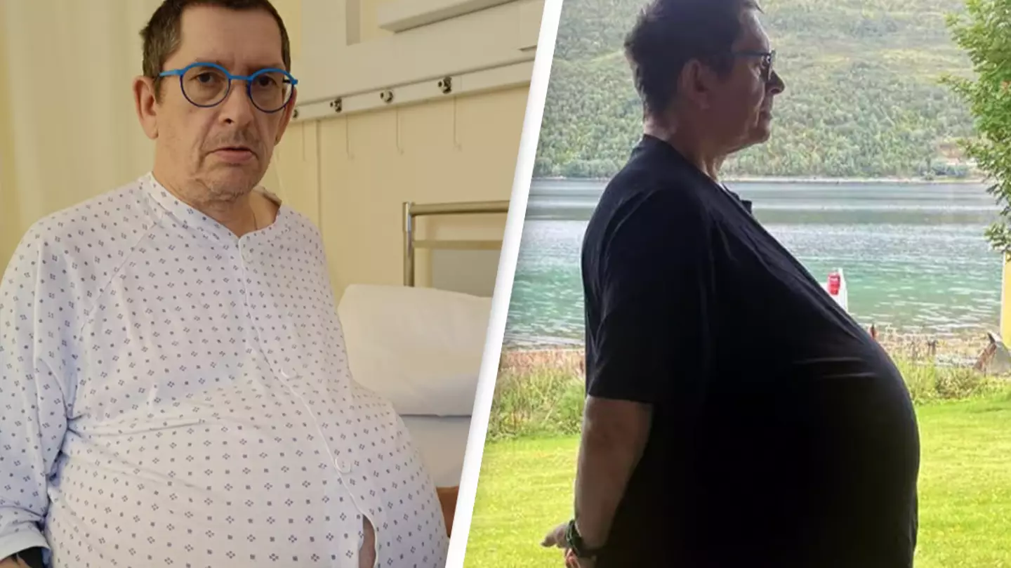 Man dismissed as 'fat' and given Ozempic before doctors discovered 60-pound tumor