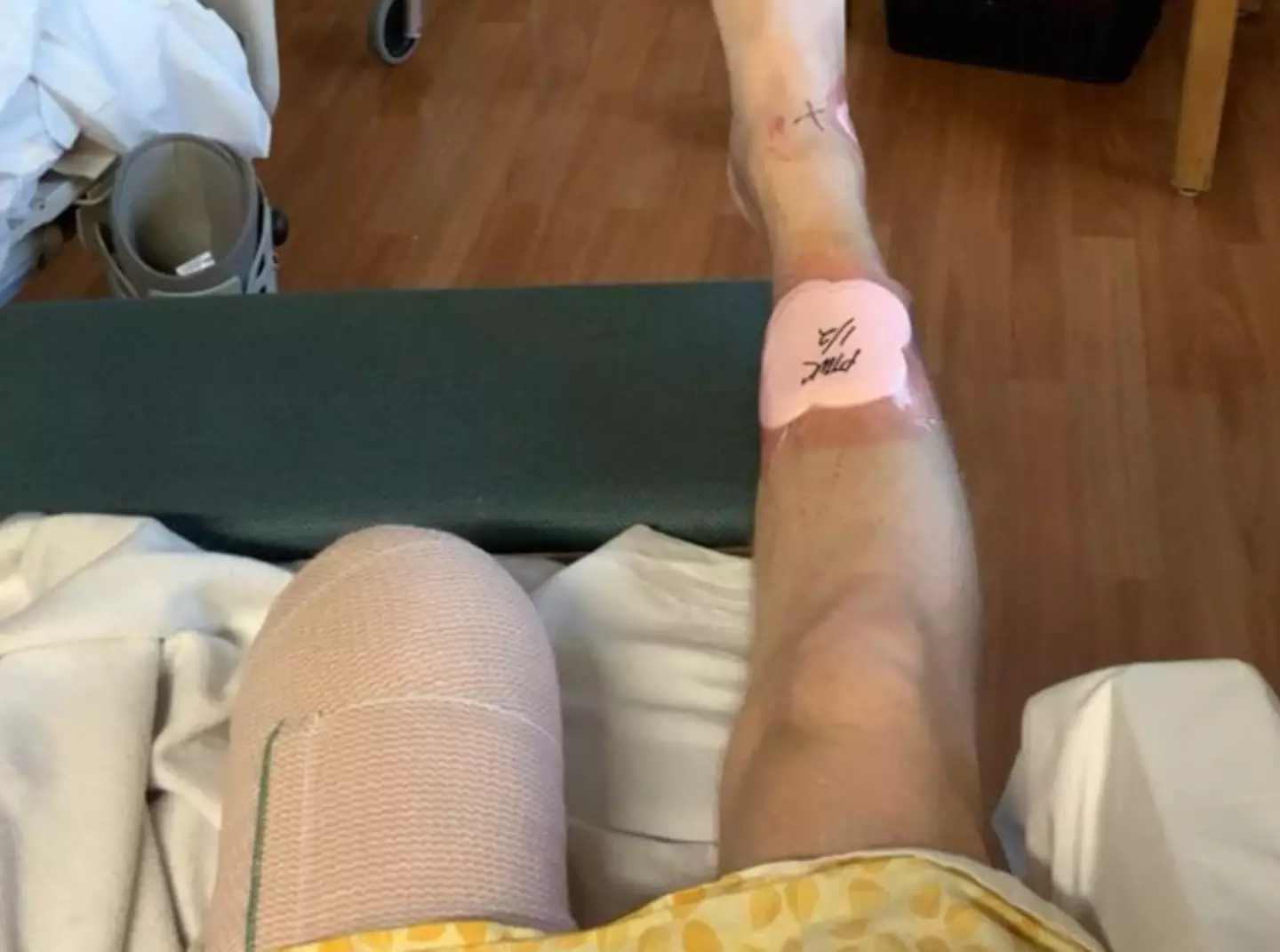 Matthew's leg was amputated after the accident. (Supplied)