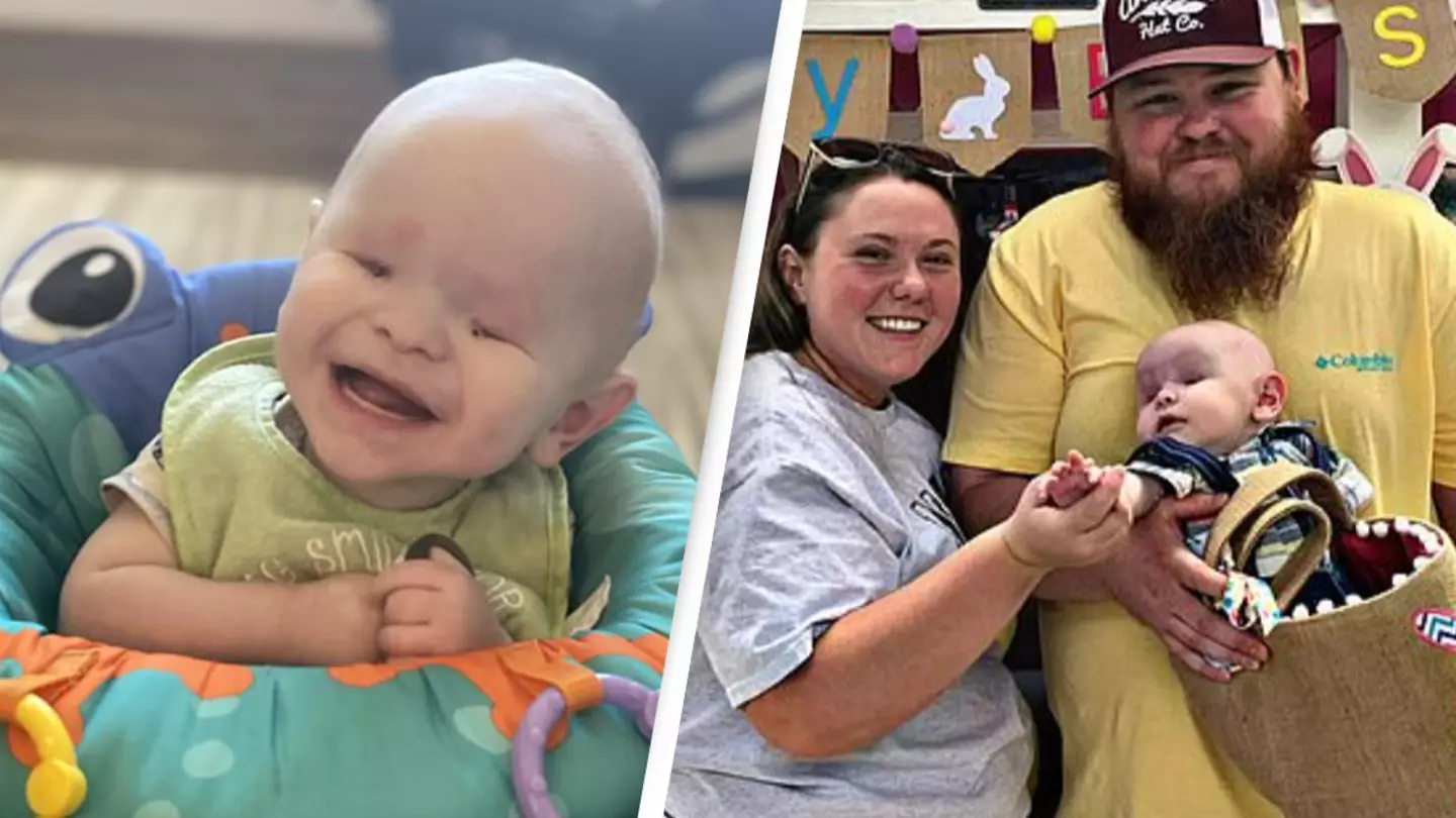 Baby born without eyes undergoes 'socket stretching' for prosthetics