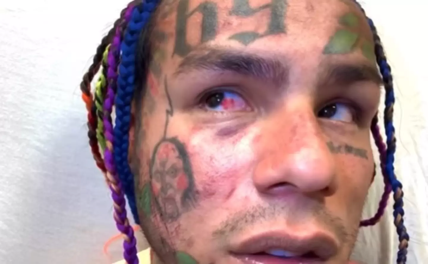 Tekashi 6ix9ine was taken to hospital for his injuries.
