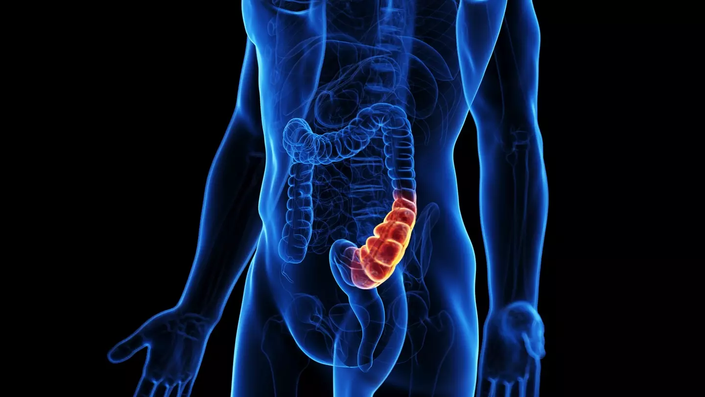 Signs of colorectal cancer can include blood in your stool (Getty Stock Image)