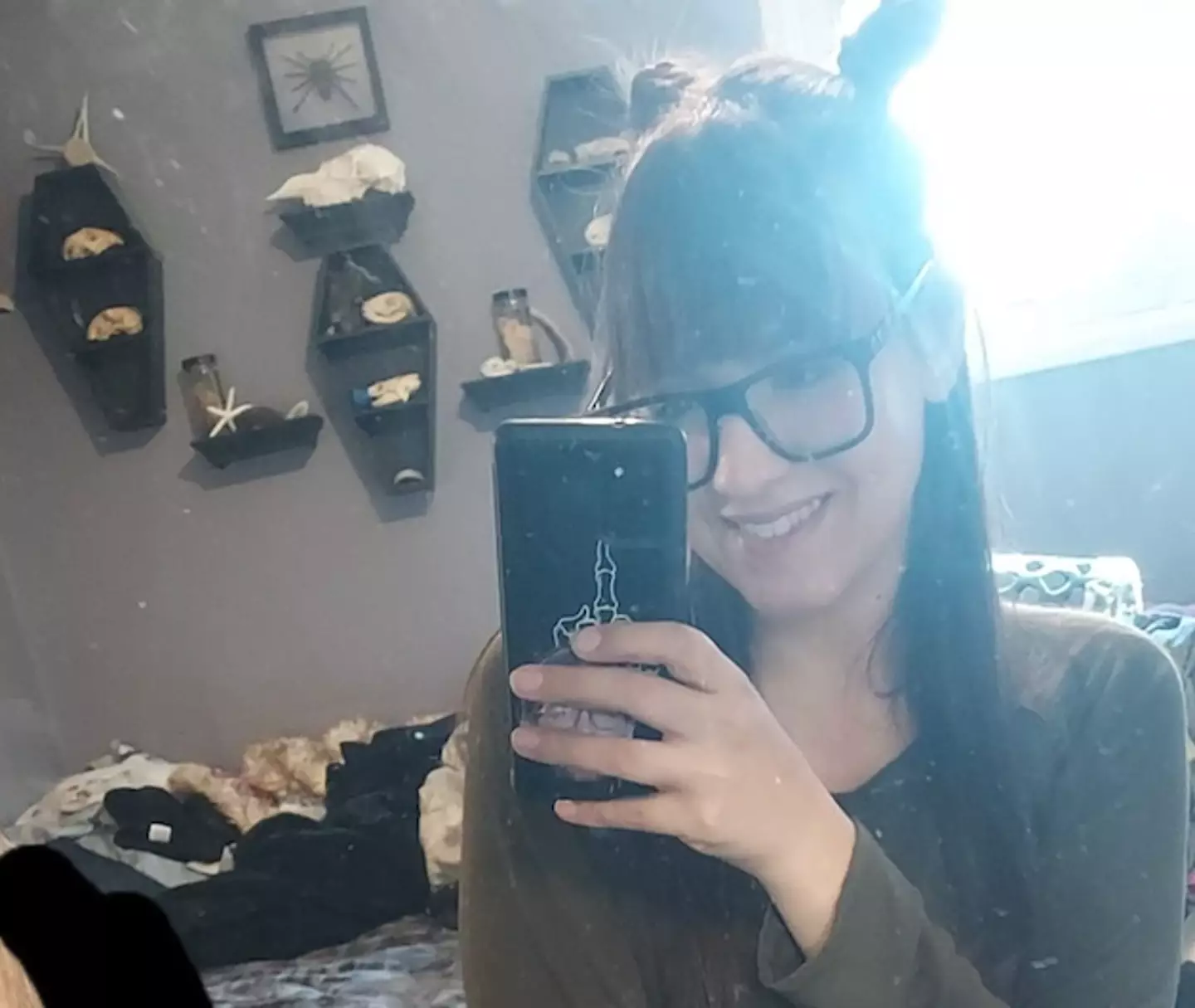Mandi first used the drugs for the wrong reasons at 17 years old (Kennedy News and Media)